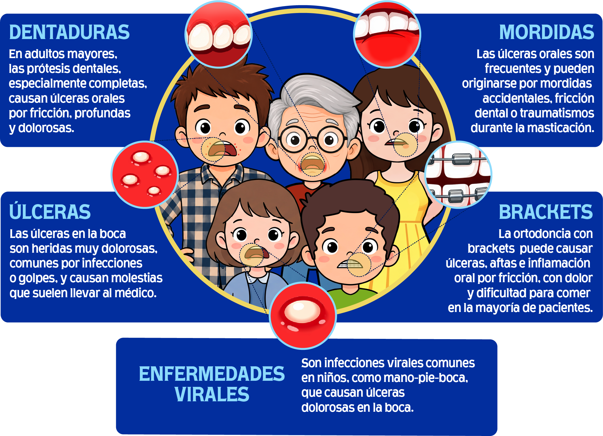 Infográfico tipos de lesiones bucales: Dentaduras, Mordidas, Úlceras, Brackets, Enfermedades Virales